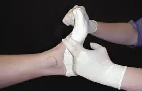 custom orthotics